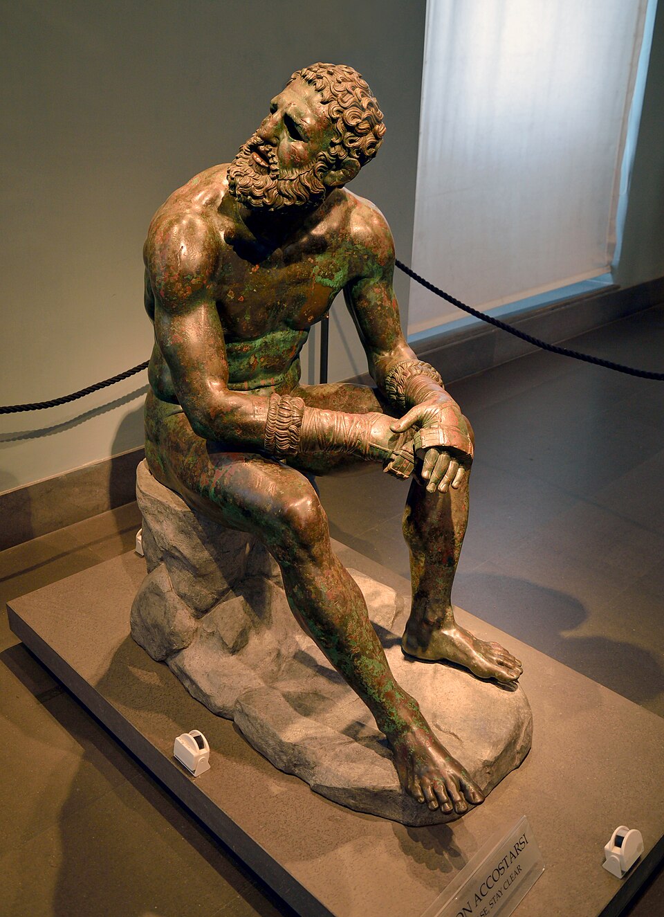 Le Pugiliste des Thermes, sculpture de Sculpteur hellénistique anonyme : Athlète nu assis après le combat, gants aux mains, visage tourné vers…